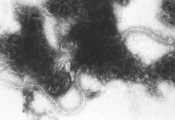 cresce alerta para sindrome respiratoria aguda grave em mato grosso e maranhao aponta fiocruz