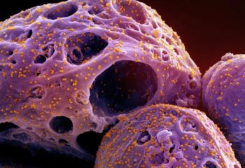 virologistas globais alertam nova variante ba 3 2 do covid demonstra maior escape imunologico