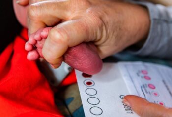 cinco anos apos lei federal teste do pezinho ampliado ainda nao inclui ame na maior parte do brasil