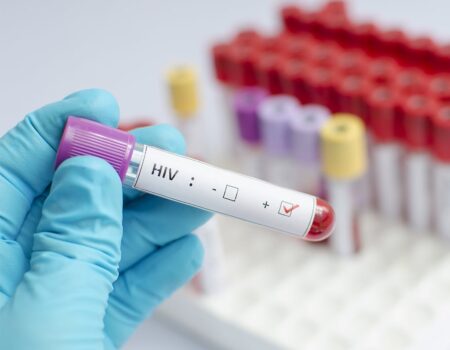 mais dois pacientes entram para lista de possiveis curados do hiv