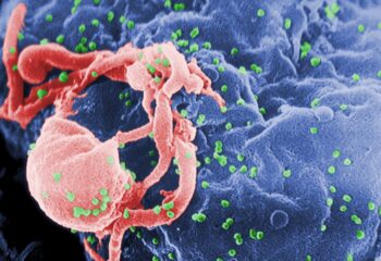 combinacao de tres terapias elimina hiv em primatas quando tratamento comeca apos o nascimento scaled