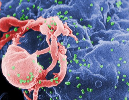 combinacao de tres terapias elimina hiv em primatas quando tratamento comeca apos o nascimento scaled