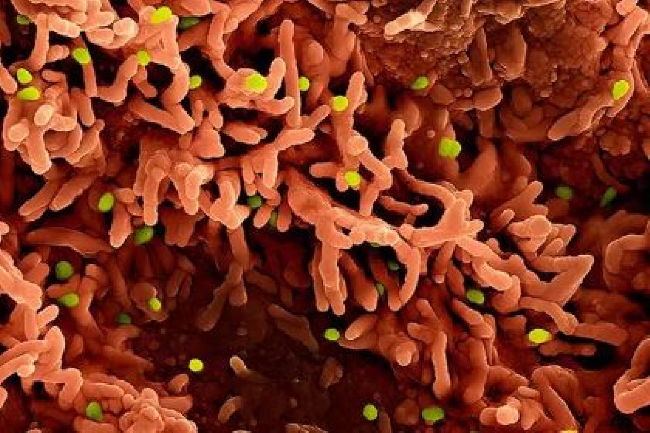 os-tres-virus-que-ameacam-causar-novas-crises-em-2026